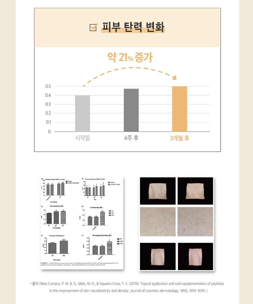 랑데린 토탈 패치 (RangdeLine) _ 미국 첫 상륙