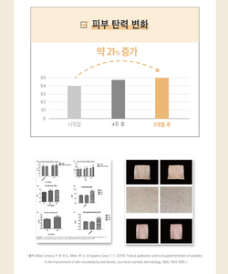 랑데린 토탈 패치 (RangdeLine) _ 미국 첫 상륙